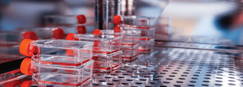 Potential CRISPR genome editing treatment for transthyretin amyloidosis