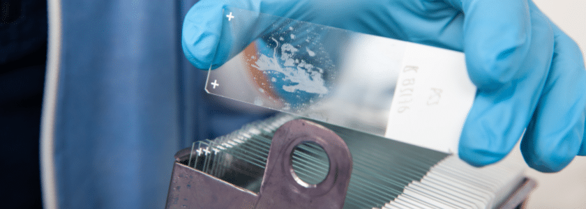 Unlocking the secrets of FFPE: Common FAQs