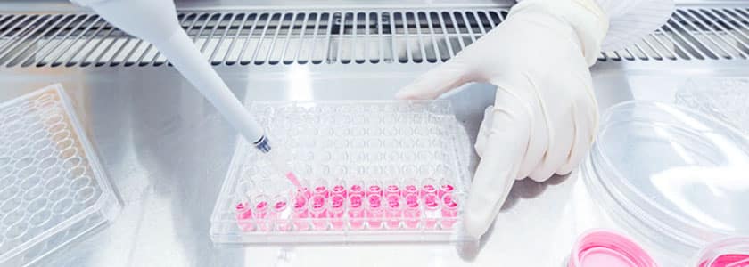 What is Prime Editing?